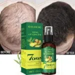 Ginger Prevent Hair Loss Scalp Treatment Oil